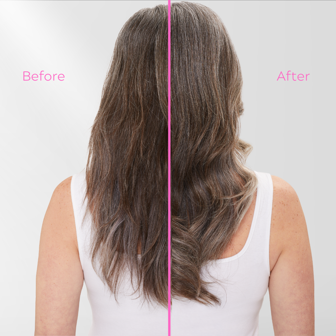 30 Second Treatment, 5 fl oz