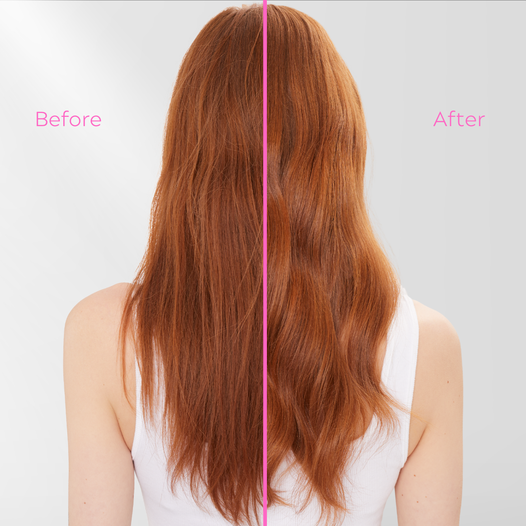 30 Second Treatment, 5 fl oz